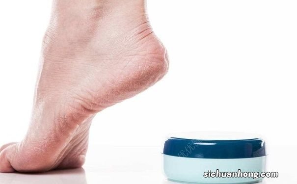 冬天脚后跟干裂怎么办?冬天脚后跟干裂如何处理?