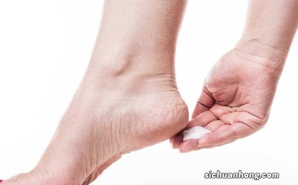 冬天脚后跟干裂怎么办?冬天脚后跟干裂如何处理?