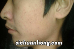 电能肌如何护理?长时间面对电脑怎么护肤?