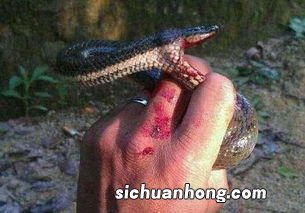 做梦被蛇咬到手是什么意思