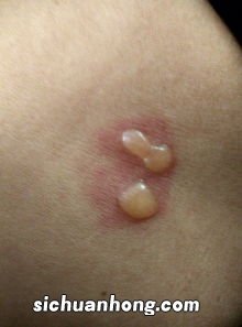 怎么才算被水泡