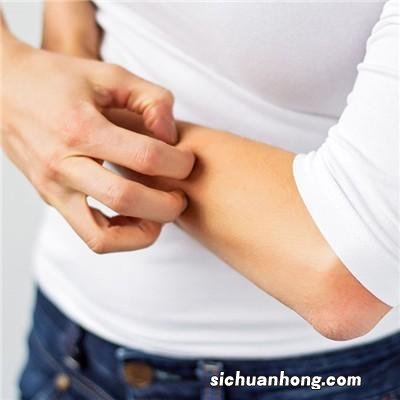 十滴水治痱子是怎样的？