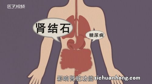 梦见别人掉头发是什么征兆