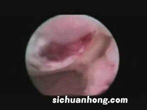 女人梦到伤口裂开什么意思