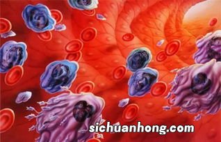 什么药清理血液垃圾