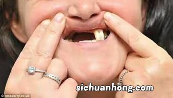 男人做梦梦到牙齿掉了什么意思