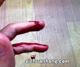 女人梦见自己胳膊流血是什么意思