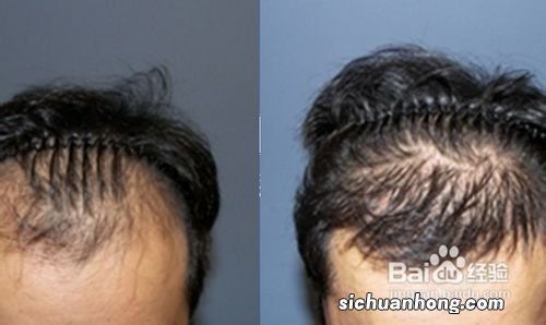 吃什么蔬菜治脱发