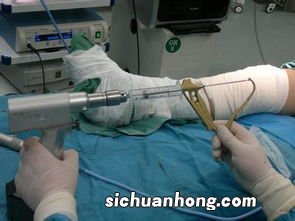 做完手术吃什么菜好