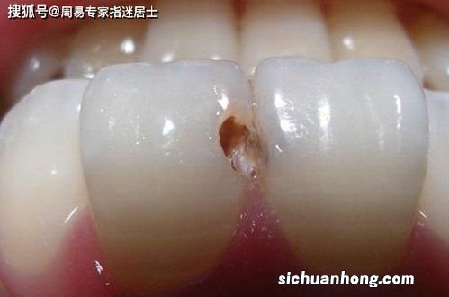 梦见掉牙