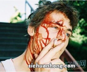 女人梦见自己头流血不止