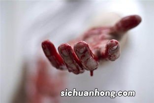 梦见自己流血了有什么征兆