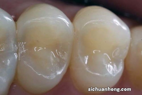 梦见自己呕吐是什么征兆