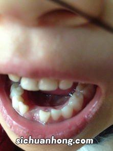 梦见下牙齿掉了一颗