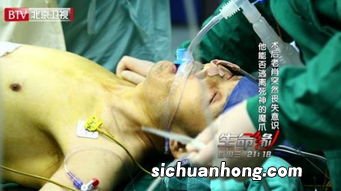 梦见自己顺产生了死胎