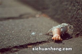 梦见胳膊断了