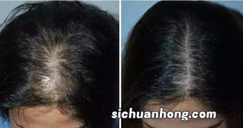 茶叶提取对头发有什么作用是什么