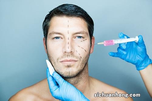 男人要做什么整容项目 男人要做什么整容项目好