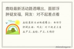 鹿晗最新活动路透曝出，面部浮肿疑发福，网友：对不起差点看成尹正