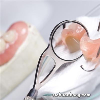 义牙有哪些分类