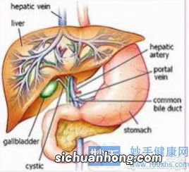 胆结石用什么手术好