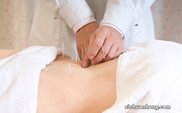 有哪些能瘦身的针灸法?瘦身的针灸法