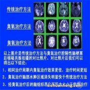 多发性脑梗塞宜吃些什么