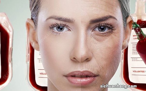 如何选择抗衰老产品?怎样选择抗衰老护肤品?