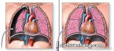 波司登羽绒服可以用洗衣机洗吗