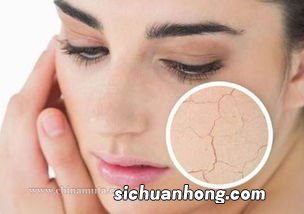 冬季皮肤干燥用什么