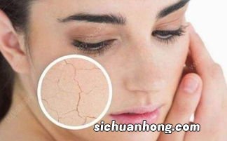 冬季皮肤干燥用什么