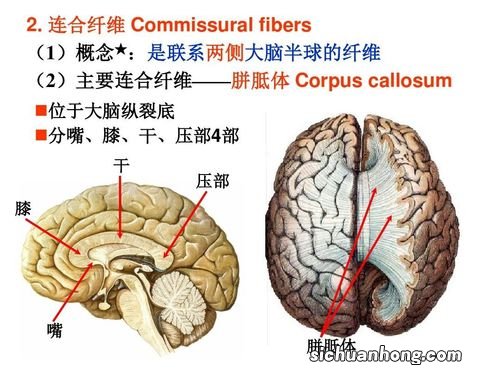 新纹状体是指