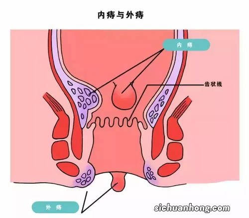 割完痔疮吃什么补品