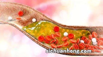 血脂不能吃什么