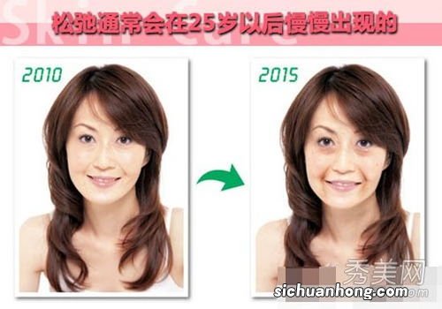 吃什么预防皮肤松弛