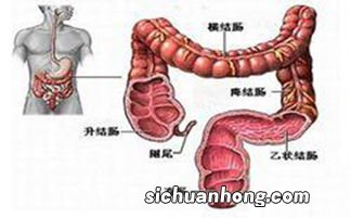 结肠癌病人不能吃什么