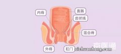 吃什么东西才能治痔疮