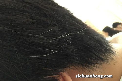 想要头发黑多吃什么调理