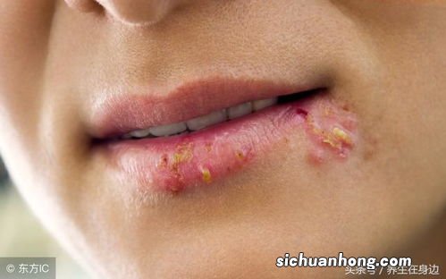 嘴唇干吃什么菜