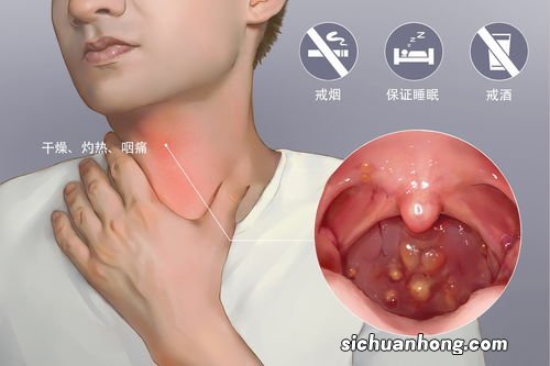 慢性咽喉炎多吃什么水果好
