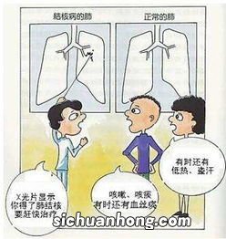 肺结核好了应该吃什么食物好