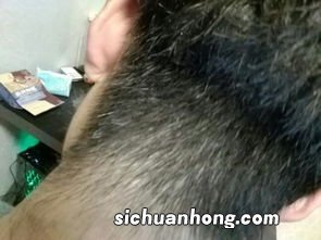 发开了面什么样子的