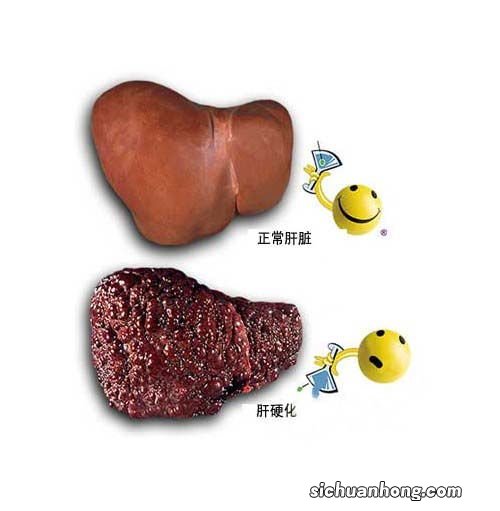 得肝病的人吃什么好