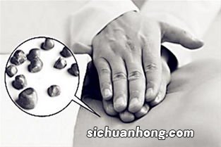 胆囊缩小吃什么食物