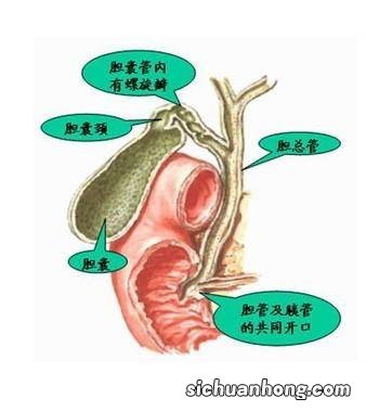 胆囊里有小结石吃什么水果好