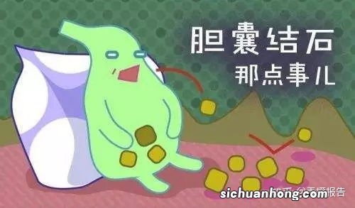 胆结石吃什么最好食疗方法